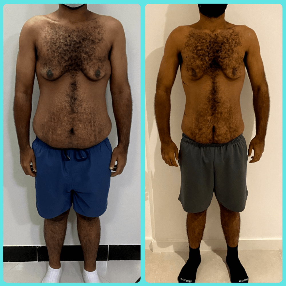Antes e depois