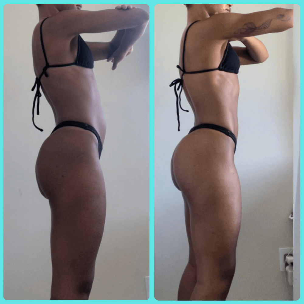 Antes e depois