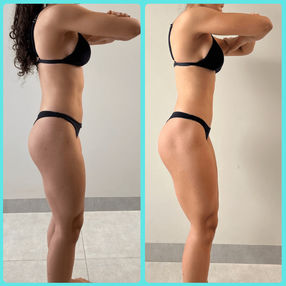 Antes e depois